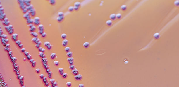 Bild zu Multiresistente Erreger - Infektionspräventives Vorgehen bei MRGN-Nachweis im Kindesalter