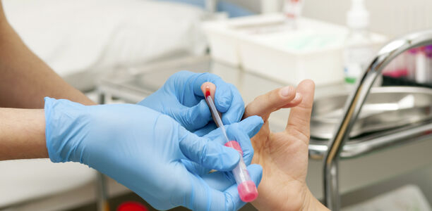 Bild zu Tuberkulose - Neues Tool erleichtert Diagnose bei Kindern