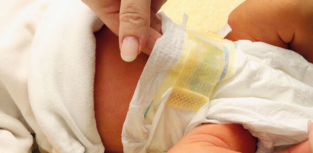 Bild zu Warnsymptom Stuhlfarbe - Neonatale Cholestase: Diagnostik, Differenzialdiagnostik und Therapie