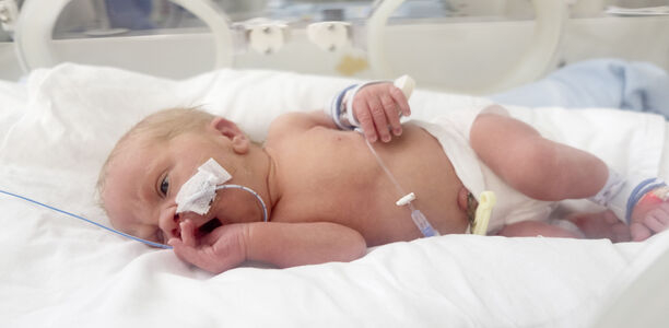 Bild zu Frühgeborene - Effekte einer frühen Ibuprofenbehandlung bei persistierendem Ductus arteriosus (PDA)?