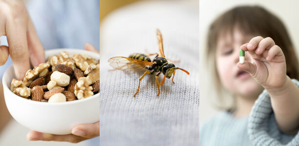 Bild zu Anaphylaxie - Anaphylaxie in der kinderärztlichen Praxis