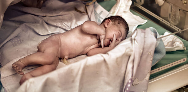 Bild zu Hypoxisch ischämische Enzephalopathie - Prognostische Einschätzung bei Neugeborenen