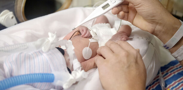 Bild zu  „Späte“ Frühgeborene - Ganzkörperhypothermie bei neonataler Enzephalopathie 