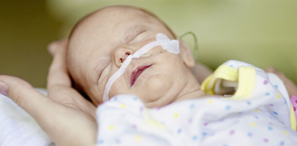 Bild zu  Frühgeborene - Längere Koffeinbehandlung wegen Apnoen?