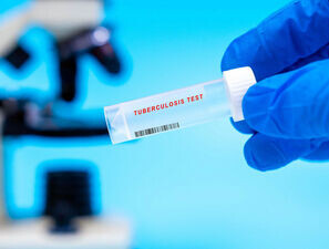 Bild zu Tuberkulose-Therapie - DGSPJ-Preis für transkulturelle Pädiatrie für Sophia Galle