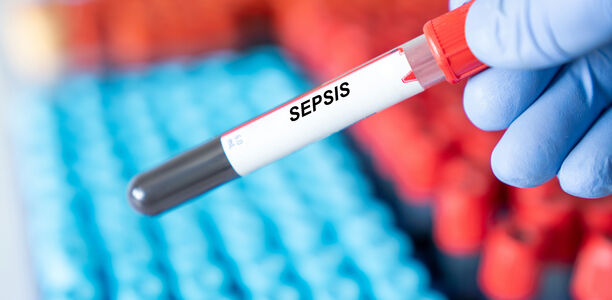 Bild zu Sepsis-Update - Was für die kinderärztliche Praxis wichtig ist